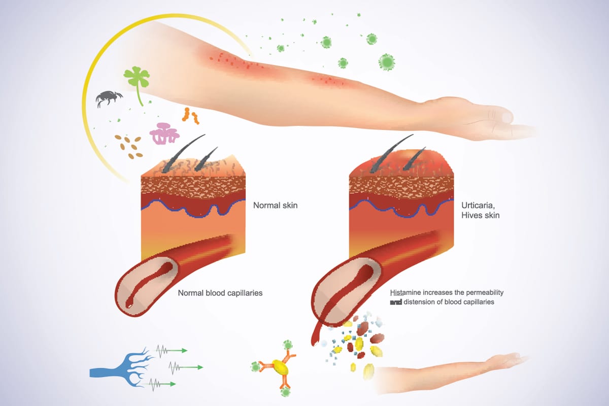 Why It Works - Rite After